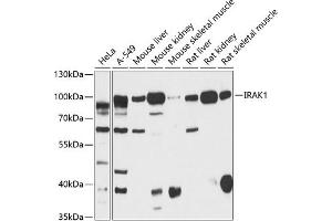 Western blot analysis of extracts of various cell lines, using IR antibody (ABIN6130497, ABIN6142514, ABIN6142515 and ABIN6216327) at 1:3000 dilution. (IRAK1 anticorps  (AA 424-633))