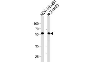 Western Blotting (WB) image for anti-Raftlin, Lipid Raft Linker 1 (RFTN1) antibody (ABIN3004469) (RFTN1 anticorps)