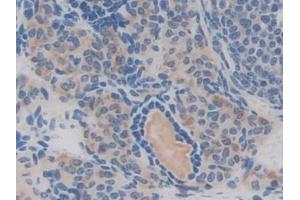 Detection of CHRD in Mouse Ovary Tissue using Polyclonal Antibody to Chordin (CHRD)