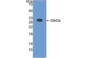 Detection of Recombinant PDCD6IP, Mouse using Polyclonal Antibody to Programmed Cell Death Protein 6 Interacting Protein (PDCD6IP) (ALIX anticorps  (AA 1-239))