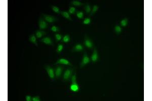 Immunofluorescence analysis of MCF-7 cell using CHAT antibody.