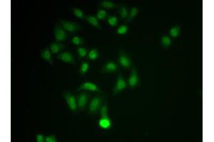 Immunofluorescence analysis of MCF-7 cell using CHAT antibody. (Choline Acetyltransferase anticorps  (AA 331-630))