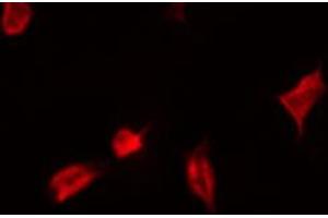 ABIN6267537 staining Hela by IF/ICC. (YAP1 anticorps  (pSer127))
