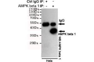 Immunoprecipitation analysis of Hela cell lysates using PK beta 1 mouse mAb.