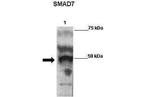 WB Suggested Anti-SMAD7 Antibody    Positive Control:  Lane 1: 2ug Flag-SMAD7 transfected 293 extracts   Primary Antibody Dilution :   1:500  Secondary Antibody :  Goat anti-rabbit-HRP   Secondry Antibody Dilution :   1:5000  Submitted by:  Anonymous (SMAD7 anticorps  (N-Term))