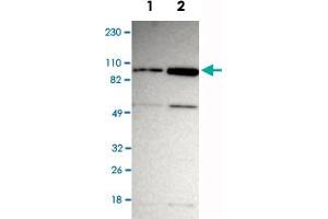 Western Blot analysis of Lane 1: RT-4 and Lane 2: U-251MG sp cell lysates with ZNF267 polyclonal antibody . (ZNF267 anticorps)