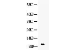 Western blot analysis of DBI using anti-DBI antibody . (Diazepam Binding Inhibitor anticorps  (AA 2-87))