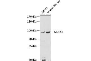 Western blot analysis of extracts of various cell lines, using MCCC1 antibody (ABIN6132337, ABIN6143628, ABIN6143629 and ABIN6214123) at 1:1000 dilution. (MCCC1 anticorps  (AA 526-725))