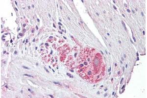 Anti-NTN4 / Netrin 4 antibody IHC staining of human small intestine, myenteric plexus. (Netrin 4 anticorps  (AA 65-76))