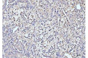 IHC analysis of ITCH/AIP4 using anti-ITCH/AIP4 antibody (ABIN7600263). (ITCH anticorps  (AA 17-358))