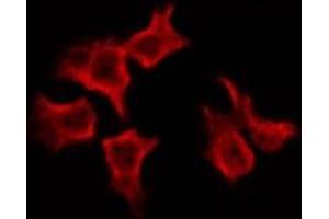 ABIN6269230 staining Hela by IF/ICC. (SREBF1 anticorps)