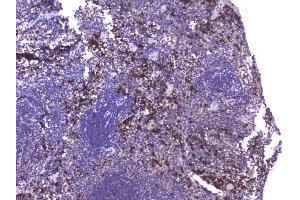 IHC analysis of CCL8 using anti-CCL8 antibody (ABIN6719605). (CCL8 anticorps  (AA 24-97))