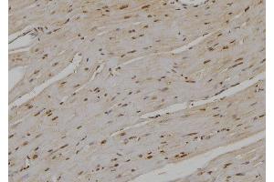 ABIN6276978 at 1/100 staining Rat heart tissue by IHC-P. (UBE2D1 anticorps  (C-Term))