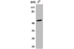 Western Blot analysis of 293 cells using Phospho-Shb (Y246) Polyclonal Antibody (SHB anticorps  (pTyr246))