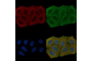 ABIN6265789 and ABIN6278090 staining Hela cells(30 min of UV treatment) by IF/ICC. (TUBA1B anticorps  (N-Term))