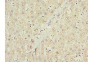 Immunohistochemistry of paraffin-embedded human liver tissue using ABIN7151087 at dilution of 1:100