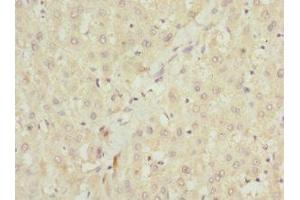 Immunohistochemistry of paraffin-embedded human liver tissue using ABIN7151087 at dilution of 1:100 (NHLRC1 anticorps  (AA 1-280))