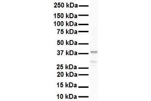 WB Suggested Anti-HNRPA3 antibody Titration: 1 ug/mL Sample Type: Human 721_B