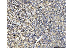 IHC analysis of UBA5 using anti-UBA5 antibody (ABIN7601503). (UBA5 anticorps  (AA 37-389))