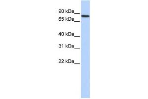 Western Blotting (WB) image for anti-Adenosine Deaminase, RNA-Specific, B2 (ADARB2) antibody (ABIN2458539) (ADARB2 anticorps)