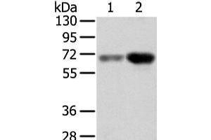 Western Blot analysis of Human lung cancer and placenta tissue using TBL1X Polyclonal Antibody at dilution of 1/500 (TBL1X anticorps)