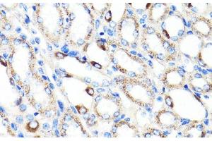 Immunohistochemistry of paraffin-embedded Mouse kidney using RNF149 Polyclonal Antibody at dilution of 1:100 (40x lens). (RNF149 anticorps)