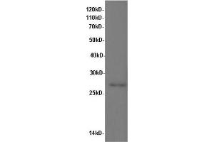 Western Blot analysis of Rat kidney tissue using IL10 Polyclonal Antibody at dilution of 1:600 (IL-10 anticorps)