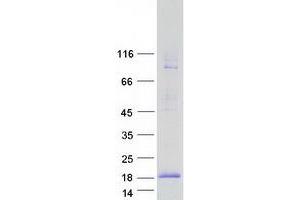 Validation with Western Blot