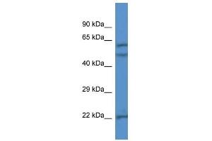 Western Blot showing HPSE antibody used at a concentration of 1 ug/ml against Jurkat Cell Lysate