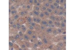 IHC-P analysis of Rat Tissue, with DAB staining. (Glucose-6-Phosphate Dehydrogenase anticorps  (AA 1-515))