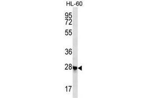 CL052 Antibody (N-term) western blot analysis in HL-60 cell line lysates (35µg/lane). (Chromosome 12 Open Reading Frame 52 (C12orf52) (AA 43-72), (N-Term) anticorps)