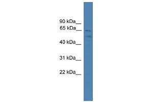 WB Suggested Anti-SPATA2 Antibody Titration: 0. (SPATA2 anticorps  (C-Term))