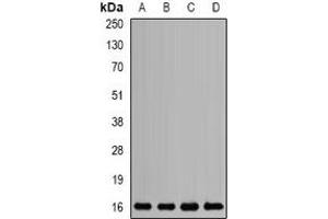 Western blot analysis of Mms2 expression in SKOV3 (A), HL60 (B), mouse liver (C), rat brain (D) whole cell lysates. (UBE2V2 anticorps)