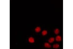 ABIN6267333 staining A549 by IF/ICC.