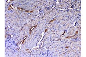 IHC analysis of HE4 using anti-HE4 antibody .