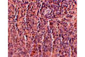 Immunohistochemical staining of rat spleen tissue with 2. (ORAI3 anticorps  (C-Term))
