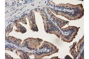 Immunohistochemistry (IHC) image for anti-Aldehyde Dehydrogenase 1 Family, Member A3 (ALDH1A3) (AA 1-100), (AA 413-512) antibody (ABIN2715887) (ALDH1A3 anticorps  (AA 1-100, AA 413-512))
