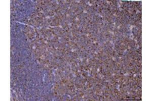 IHC analysis of Eg5/KIF11 using anti-Eg5/KIF11 antibody (ABIN7600277).