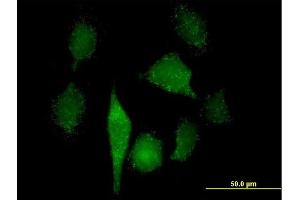 Immunofluorescence of purified MaxPab antibody to GNPAT on HeLa cell.