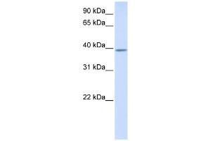 KLHDC2 antibody used at 1 ug/ml to detect target protein. (KLHDC2 anticorps  (N-Term))