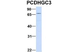 Host:  Rabbit  Target Name:  CHAD  Sample Type:  Human Adult Placenta  Antibody Dilution:  1. (Protocadherin gamma Subfamily C, 3 (PCDHGC3) (C-Term) anticorps)
