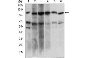 Western blot analysis using PAPLN mouse mAb against Hela (1), HepG2 (2), OCM-1 (3), Raji (4), Jurkat (5), NIH/3T3 (6) cell lysate. (PAPLN anticorps  (AA 766-870))