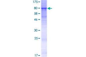 Image no. 1 for Kelch-Like 23 (KLHL23) (AA 1-558) protein (GST tag) (ABIN1308811)