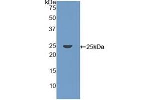Detection of Recombinant CORO1A, Human using Polyclonal Antibody to Coronin 1A (CORO1A)