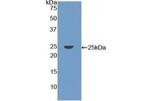 Detection of Recombinant CORO1A, Human using Polyclonal Antibody to Coronin 1A (CORO1A) (Coronin 1a anticorps  (AA 7-204))