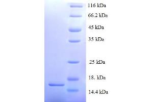SDS-PAGE (SDS) image for Serum Amyloid A2 (SAA2) (AA 20-122) protein (His tag) (ABIN4974919) (SAA2 Protein (AA 20-122) (His tag))