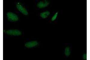 Immunofluorescent staining of HeLa cells using anti-AP2M1 mouse monoclonal antibody (ABIN2454660). (AP2M1 anticorps  (AA 97-383))