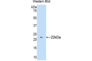 Detection of Recombinant a1BG, Human using Polyclonal Antibody to Alpha-1-B-Glycoprotein (a1BG)