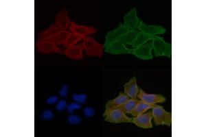 ABIN6258861 and ABIN6274219 staining Hela cells(30 min of UV treatment) by IF/ICC.