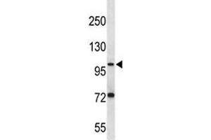 PSMA antibody western blot analysis in ZR-75-1 lysate. (PSMA anticorps  (AA 161-190))